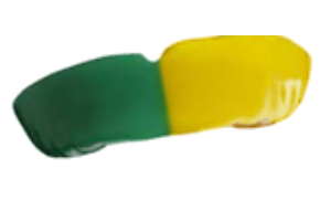 Two Striped Mouthguards, Custom Made in Scotland